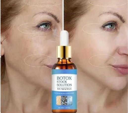 Botox Stock Solution Antiarrugas